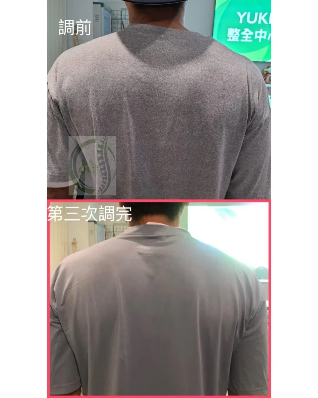 Yuki Holistic Centre featured Rednote post: 個案分享：一次到位不拖症
